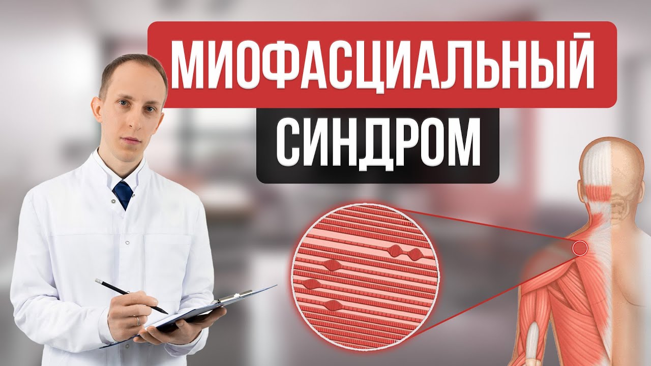 Боль, связанная с мышцами: миофасциальный болевой синдром и фибромиалгия