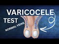 Varicocele Ka Desi ilaj | Varicocele Symptoms &amp; Treatment Without Surgery | Varicocele Kya hota hai