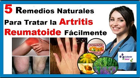 ¿Cuál es el mejor remedio casero para la artritis grave?