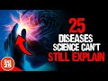 25 mind boggling diseases that science cant explain