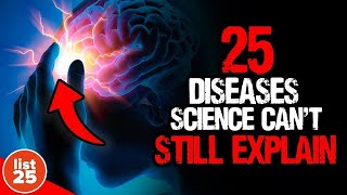 25 Mind Boggling Diseases That Science Can&#39;t Explain