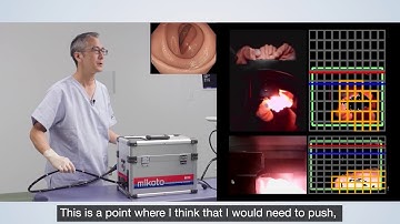 Basic Techniques of Colonoscope Insertion by Mikoto Colonoscopy Model