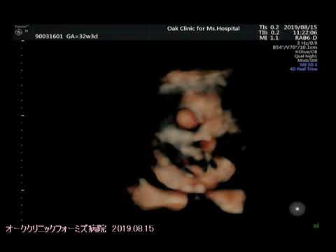 妊娠３２週３日 Youtube