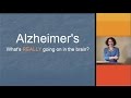 Alzheimer