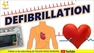 Defibrillation I Indications I Operating modes I Types of defibrillator I Waveform I AED steps