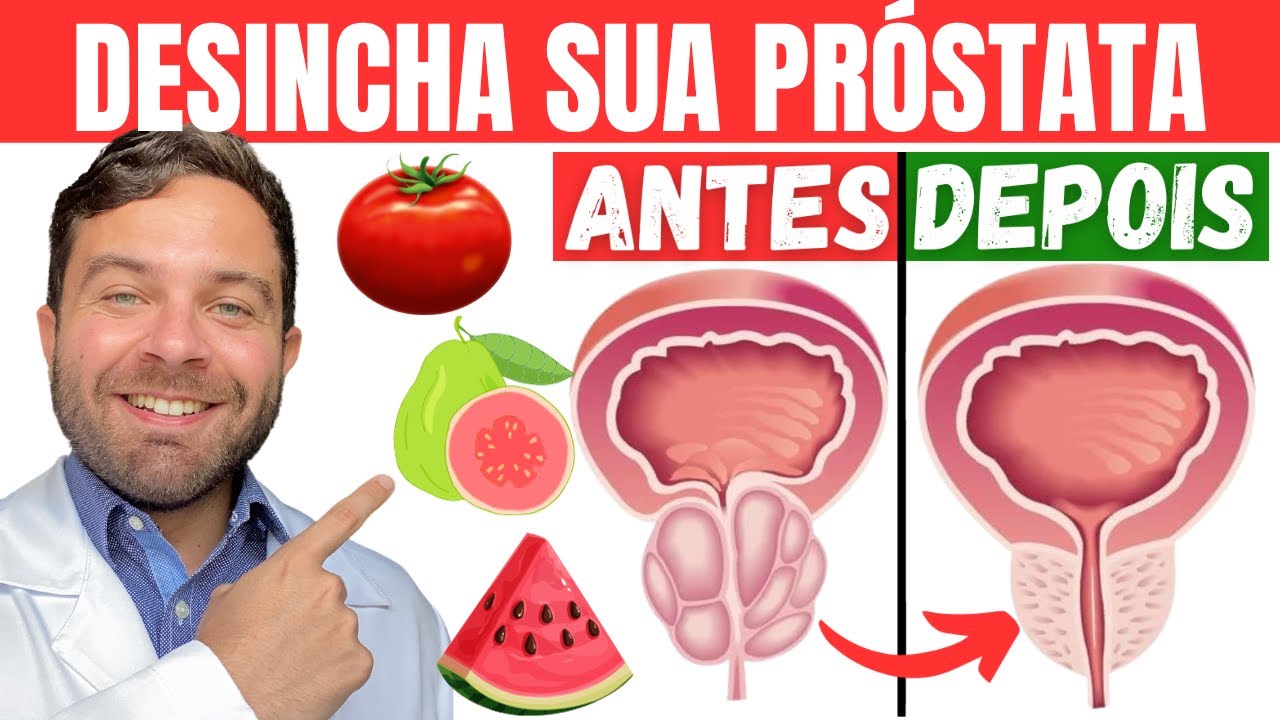 COMA ISSO para DESINCHAR PRÓSTATA AUMENTADA | Remédio natural para ...