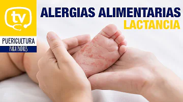 ¿Cuál es la alergia más frecuente en un bebé amamantado?