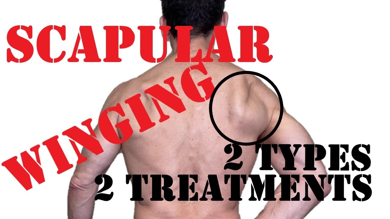 Scapular Winging Fix Treat Medial And Lateral Winging YouTube