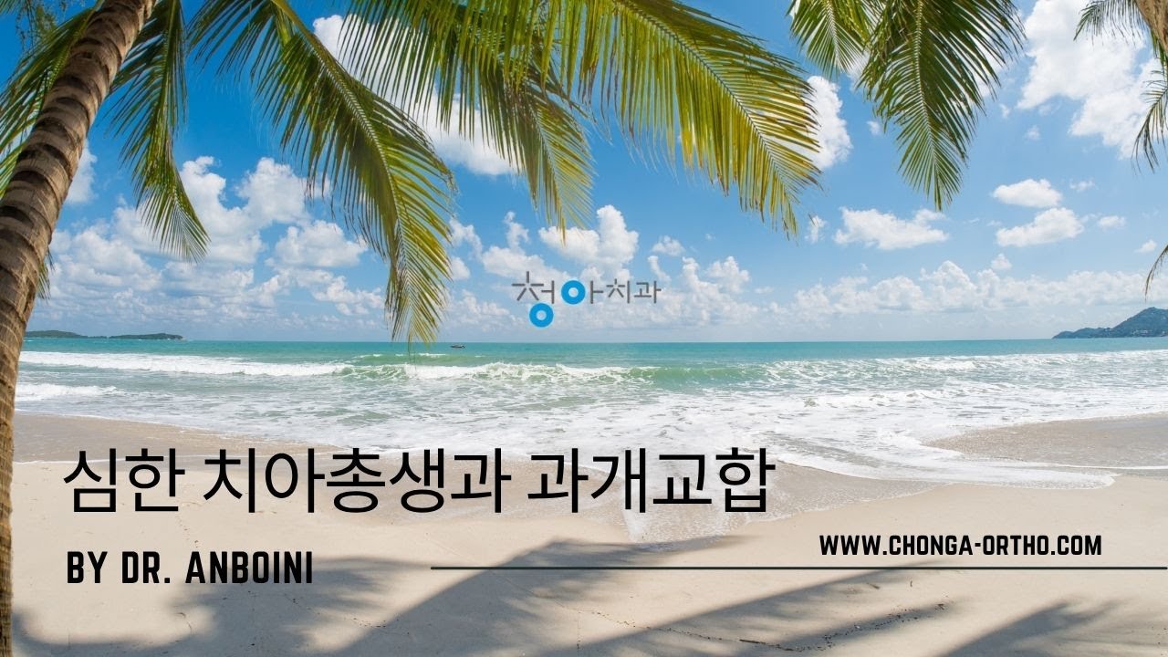 심한 치아총생과 과개교합의 비발치 치아교정