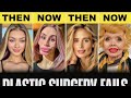 “The DARK Truth About Celebrity Plastic Surgery Will SHOCK You 😱 (Gone Wrong)”
