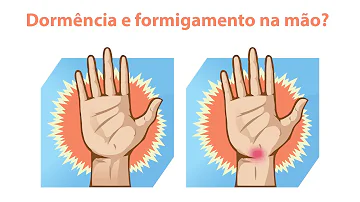 O que é bom para mãos dormentes?