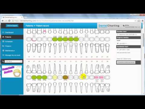 Practice Dental Charting Online Free
