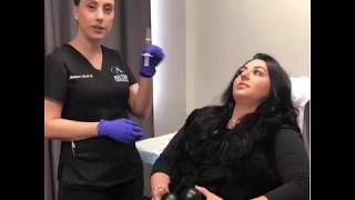 Lip injections with Restylane at Aydin Plastic Surgery