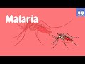 Pathophysiology of Malaria [Life cycle of the plasmodium parasite, Common symptoms]