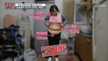 자극적인 음식 사랑의 그녀♥ 위기의 복부비만 ;; [내 몸 플러스] 180회 20200119