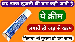 दाद खाज खुजली की बाप कही जाती है ये क्रीम लगाते ही जड़ से खत्म | Ring Guard Cream Ke Fayde Uses