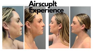 Go Under the Knife with me - Vlog Airsculpt