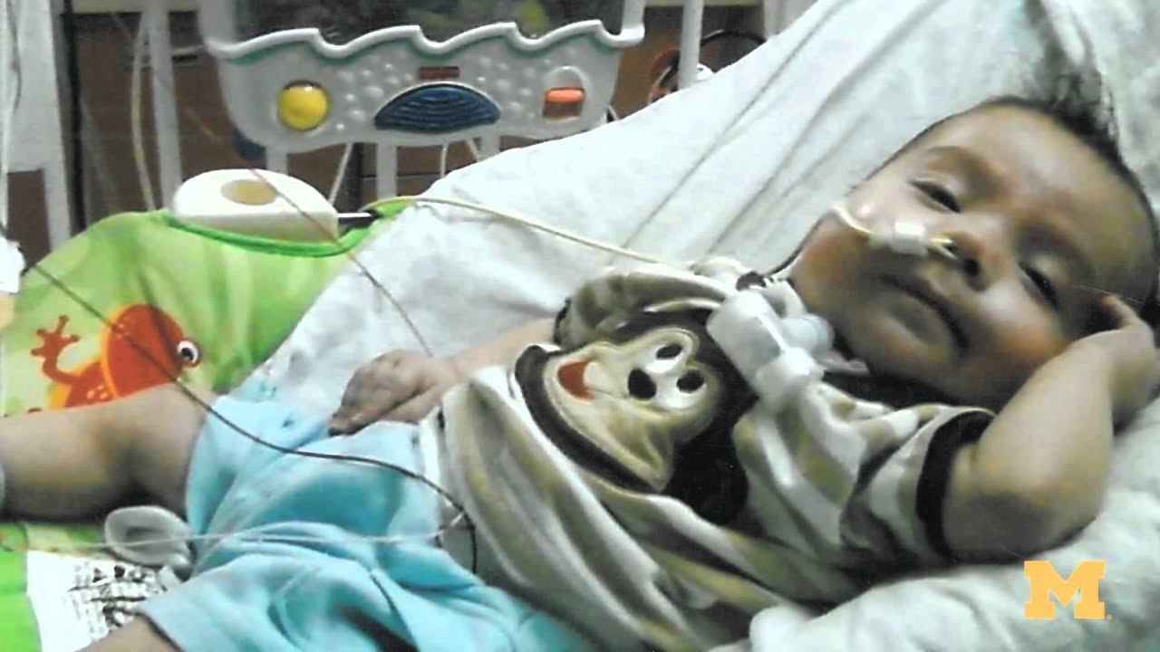 groundbreaking treatment for tracheobronchomalacia YouTube