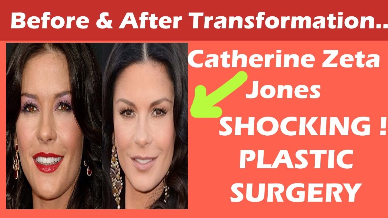 catherine zeta jones surgery catherine zeta jones plastic surgery before and after full catherine zeta jones surgery catherine zeta jones plastic surgery before and after full