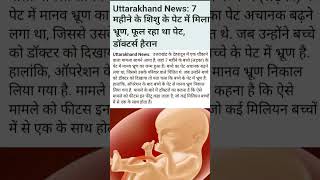 Rare Medical Case: Zygote Found in 7-Month-Old 🤯 #Shorts #AmazingFacts #ScienceFacts #Trending