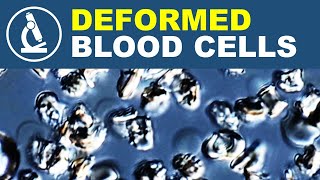 Why SALT causes cells to shrink | Blood under the microscope