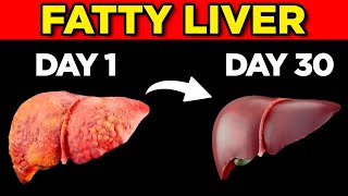 HOW TO CLEANSE LIVER FAT: The Top 5 Foods to Reverse Steatosis (and the 5 Worst)