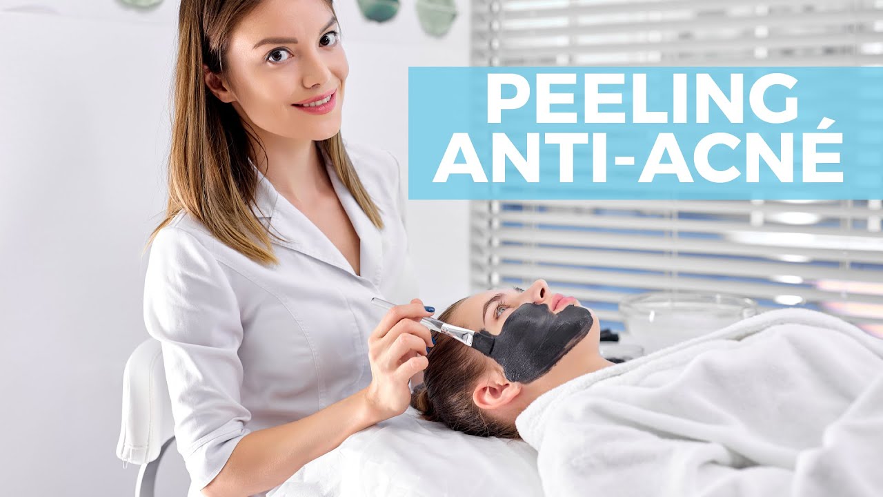 PROTOCOLO PEELING ANTI ACNE