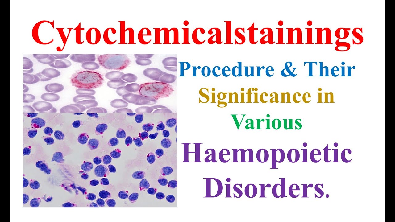 Cytochemical Staining Procedure & Their Significance in Various Haemopoietic Disorders | Lab Techniq
