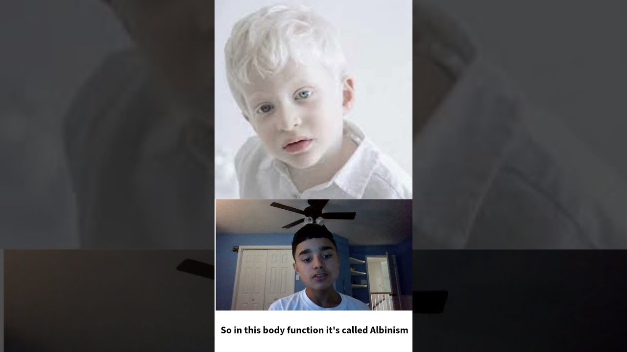 Rarest Body Functions in the World!!