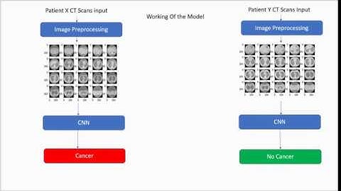 Product Overview of Lung Cancer Detection using CNN