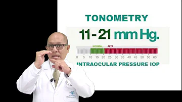 ¿Qué presión ocular se considera glaucoma?