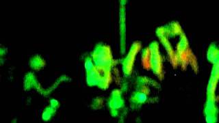 Medusa dance PS 225 part 2