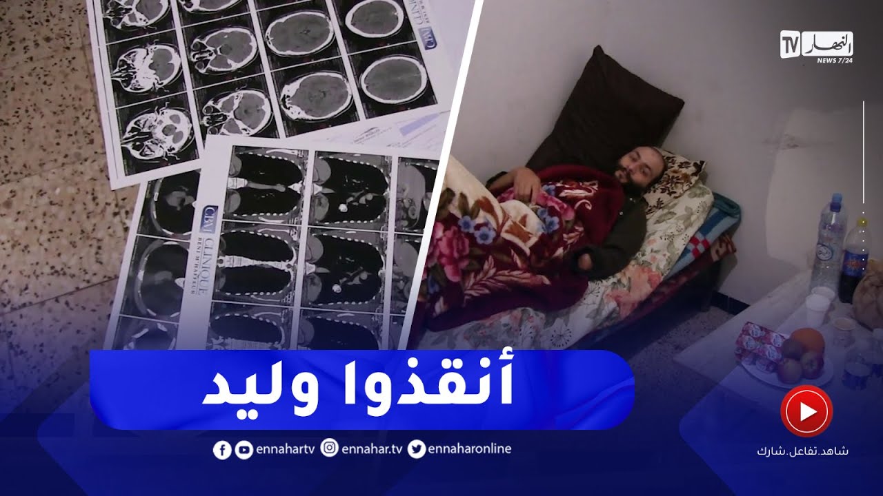 الطارف / الشاب وليد هباش مريض يناشد السلطات لمساعدته في رحلة العلاج بالخارج