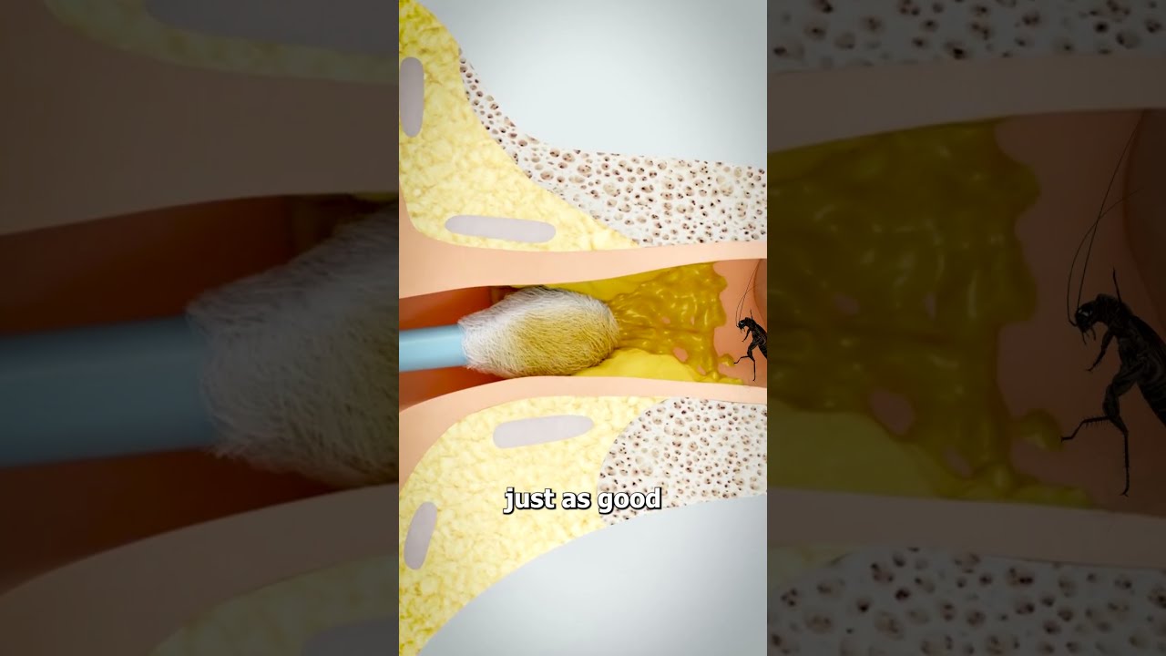 Why You Should Check Your Ears For Bugs 