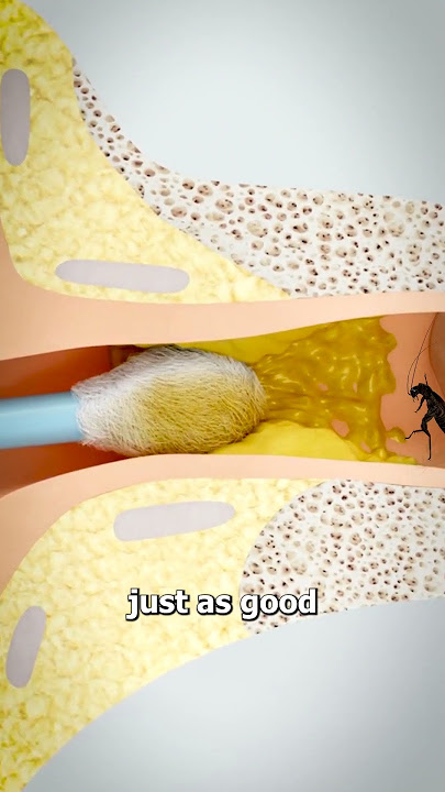 Why You Should Check Your Ears For Bugs 😨