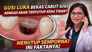 Gusi luka bekas cabut gigi apakah akan tertutup atau tidak?