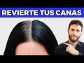Las Canas Se Frenan De Esta Manera 