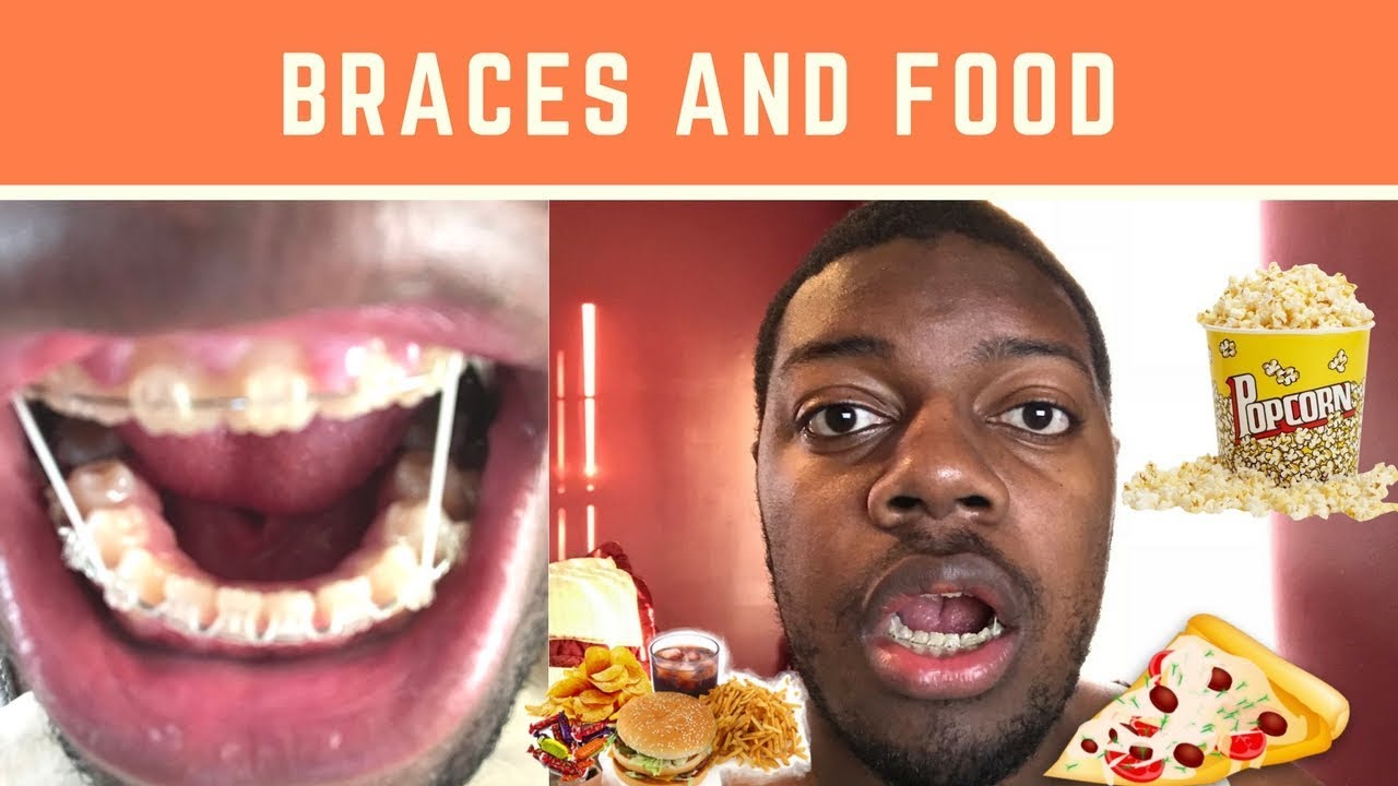 Braces and Food - YouTube