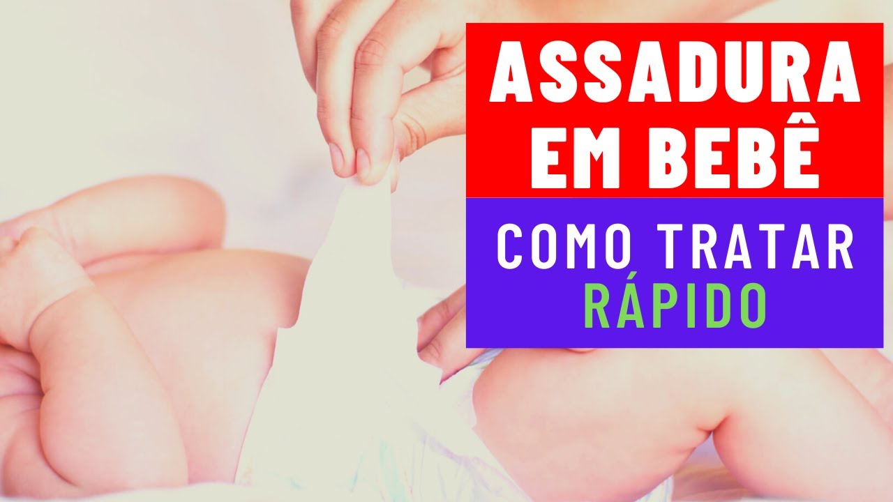 Como Tratar e Curar Assaduras em Bebê Simples e Rápido! - YouTube