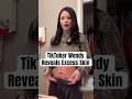 TikToker Wendy Ortiz Reveals Excess Skin #shorts #wendyortiz #momlife