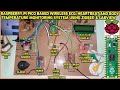 Raspberry Pi Pico for Real-Time Patient Monitoring 🚑