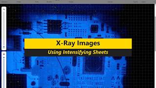 Xray Images with Intensifying sheets Xray Images with Intensifying sheets