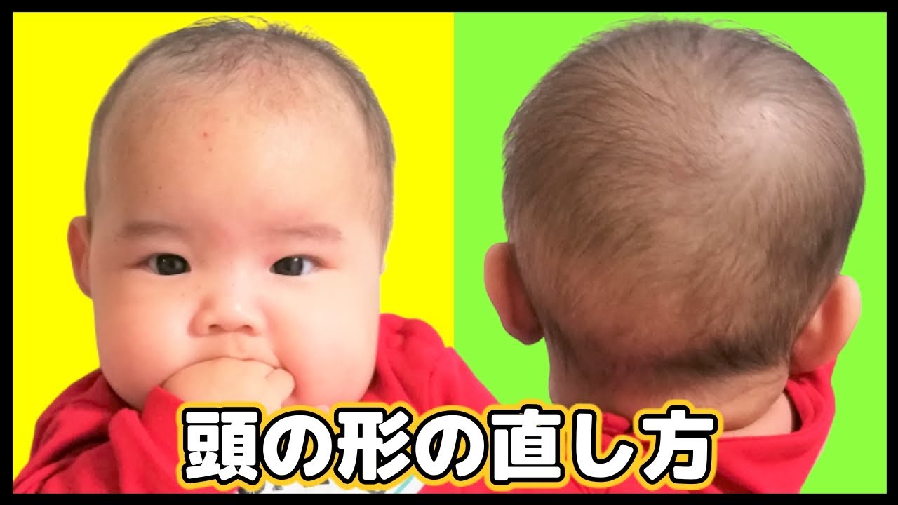 赤ちゃん 頭の形を良くする方法 向き癖の直し方 5ヶ月 Youtube