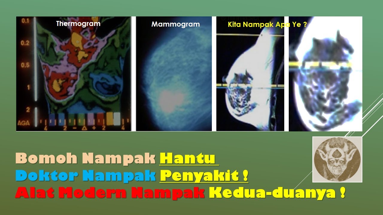 Bagaimana Peralatan Modern Dapat Mendeteksi Penyakit Dan 