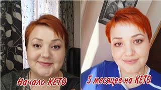 5 месяцев Кето/ Мои результаты/ Не выдержала/ Кето рацион