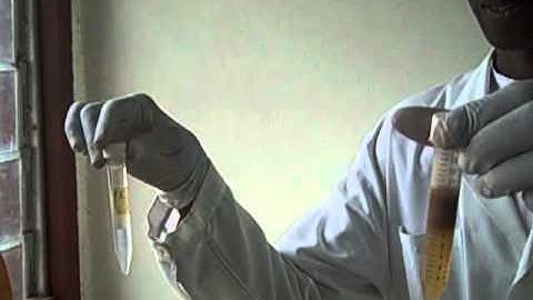 Fecal Parasite Examination - The Formol-Ether Concentration - Multi-Lingual Captions