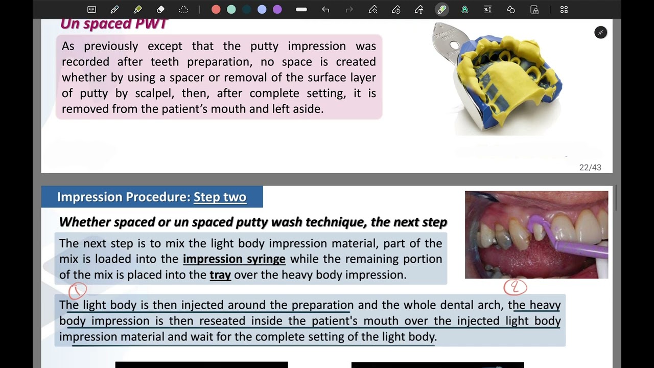 Lec Impression techniques and disinfection |crown and Bridge| fifth stage P2