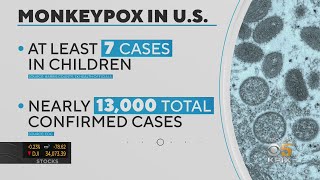 Monkeypox update: WHO warning on pets; new rapid test; SF clinic closes;