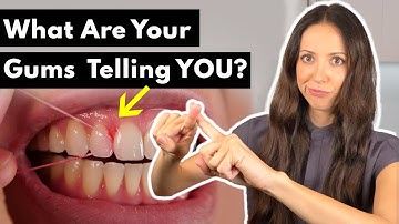 Why Do Gums HURT & BLEED After Flossing?