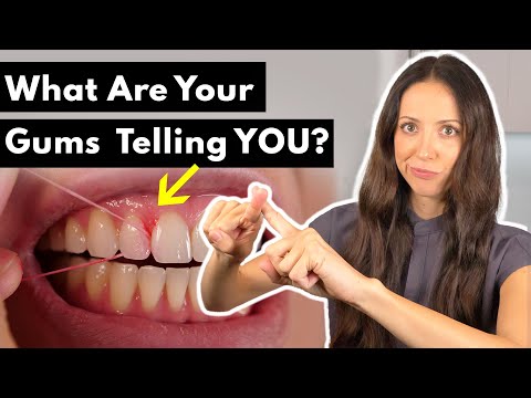 Why Do Gums HURT & BLEED After Flossing?